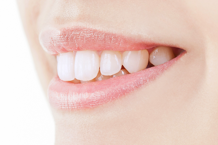 歯の美しさを追求する治療で美しい口元に