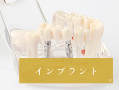 インプラント